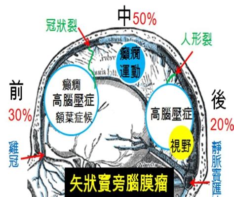 大腦簾